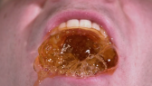 Teeth Soda