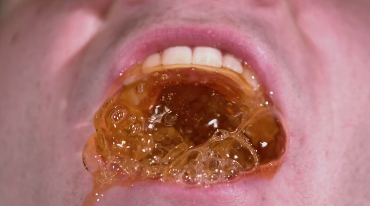 Image: What Happens When You Put Teeth In Soda (Video)