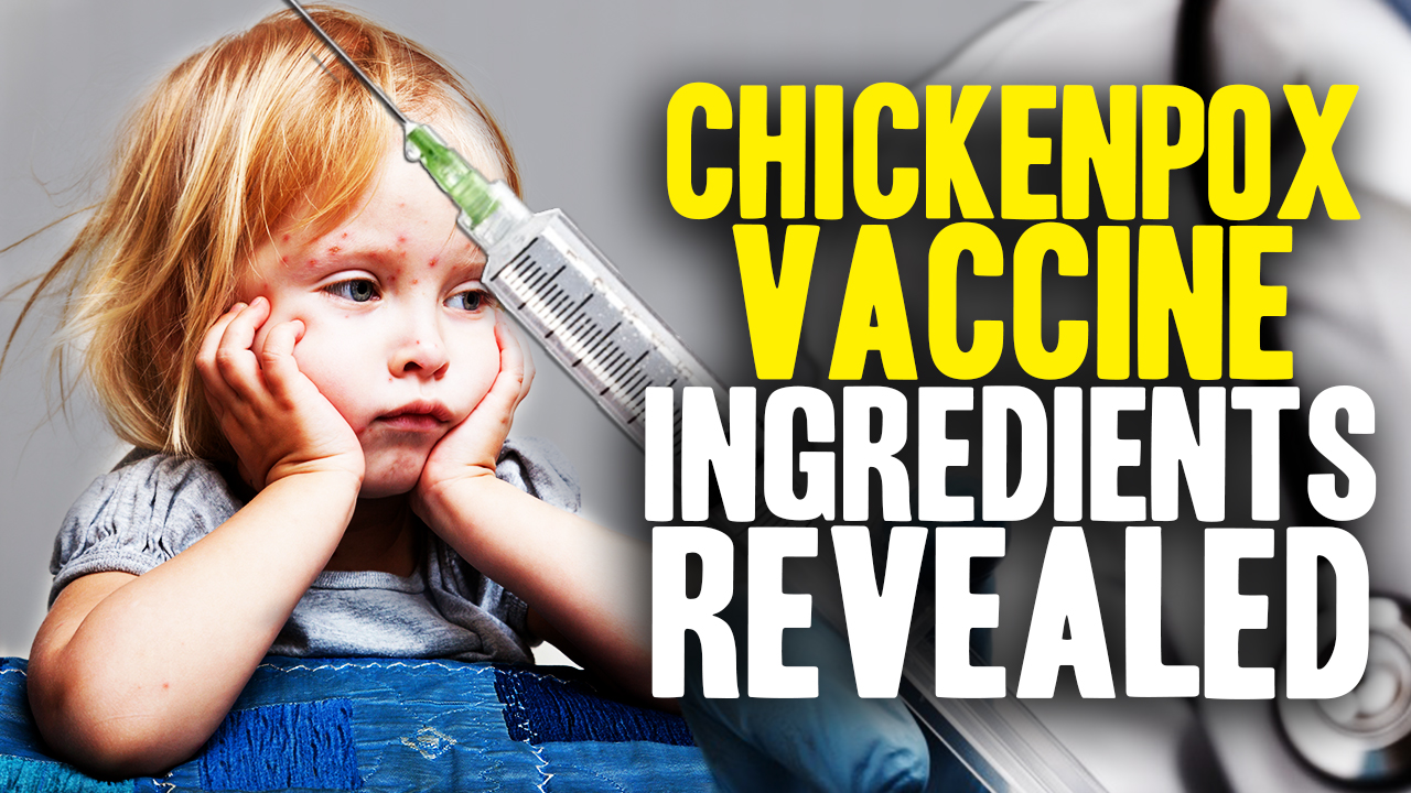 Image: CDC Releases Chicken Pox Vaccine Ingredients (Video)