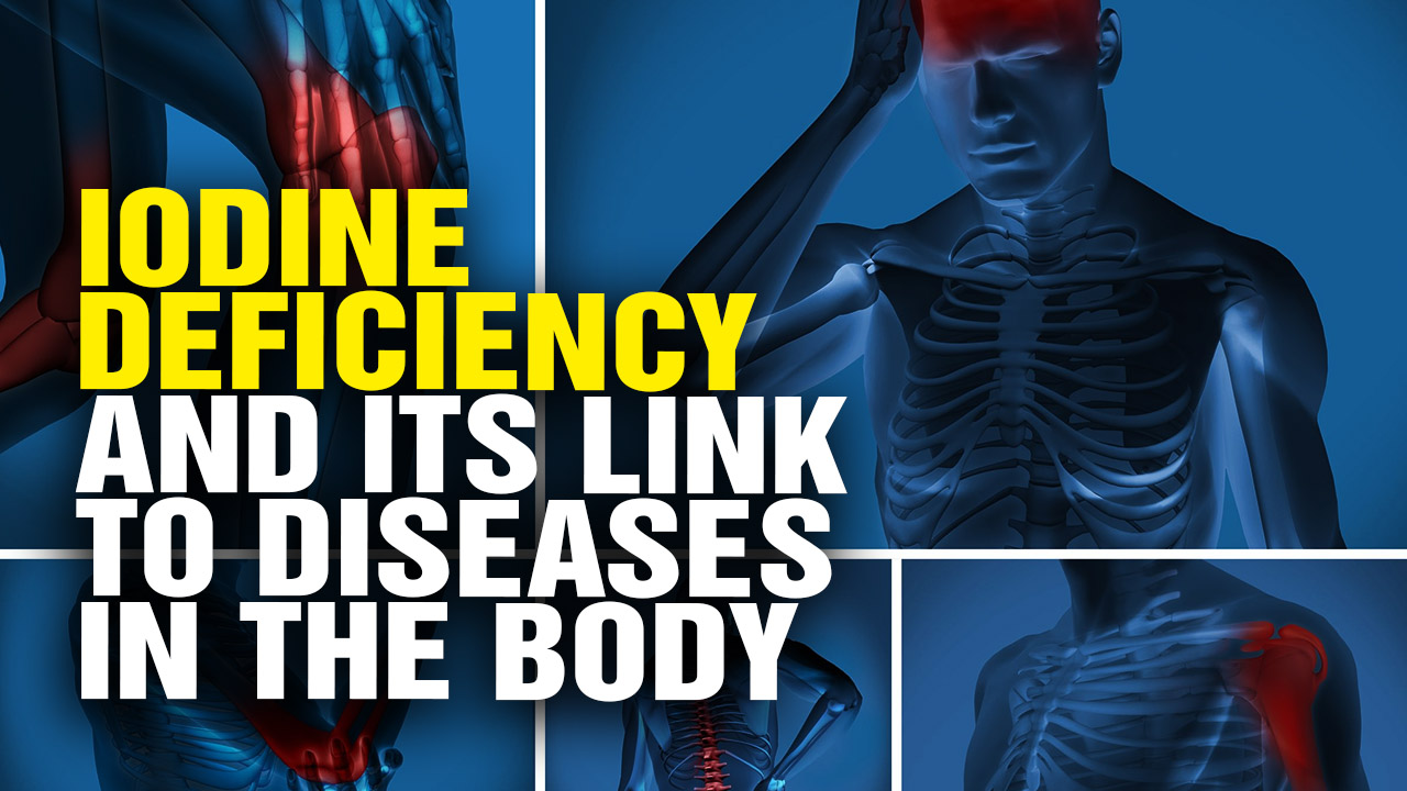 Image: Iodine Deficiency and Its Link to Diseases in the Body (Video)