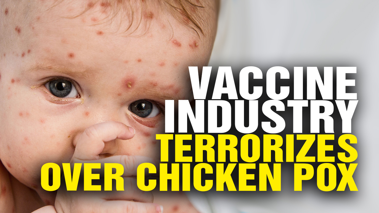 Image: Vaccine Industry TERRORIZES Families over CHICKEN POX! (Video)