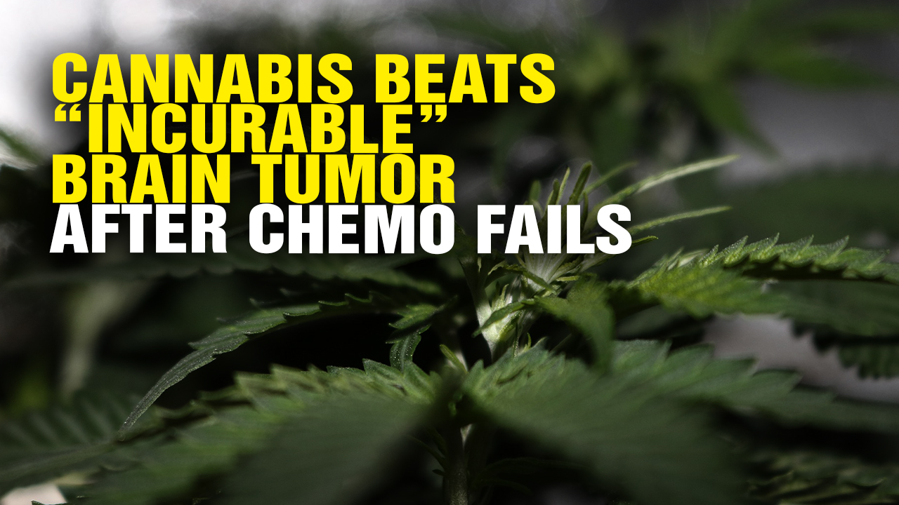 Image: Cannabis Beats “Incurable” Brain Tumor After Chemo Fails (Video)