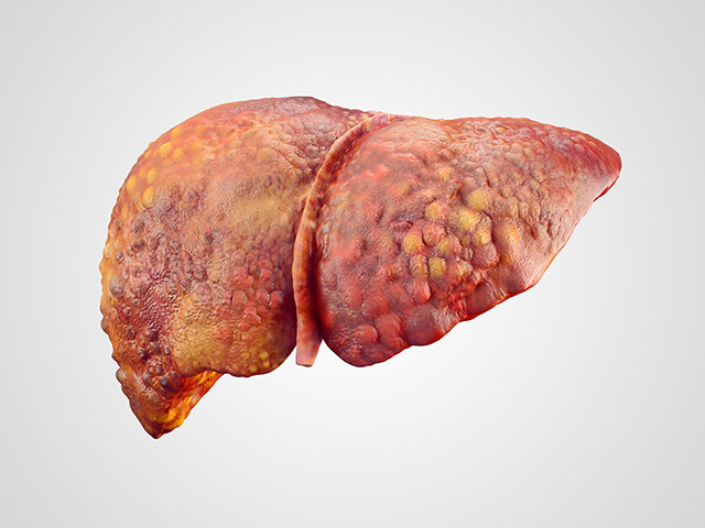 Image: 10 Warning Signs Your Liver Is Full of Toxins (Video)