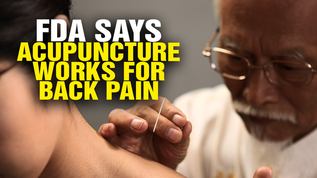 Image: FDA Wants Doctors to Recommend Acupuncture and Chiropractic Care for Back Pain (Video)